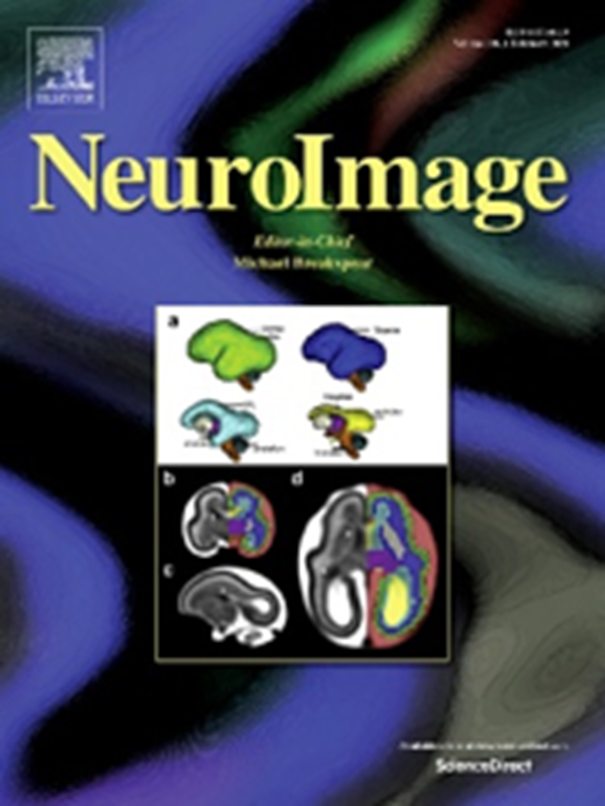 Results of a project funded by the BIAL Foundation presented in the journal Neuroimage