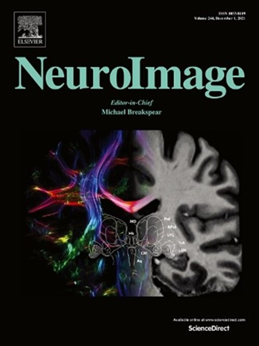 Neural signature of attentional reorienting